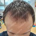 After 2 Month