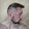 Result 6 months