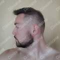 Result 6 months