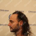 Before second operation