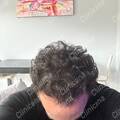 Result second operation