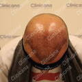 After first operation