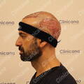 After second operation
