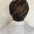 After 9 months