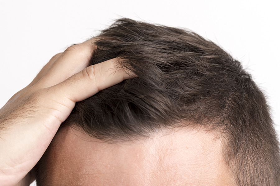 ▷ What is folliculitis? | Is Folliculitis contagious? ▷ What is folliculitis? | Is Folliculitis contagious?