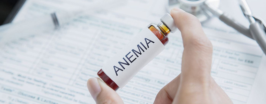 relationship between anaemia and hair loss