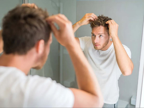 Who Is at Risk of Hair Loss from Creatine?