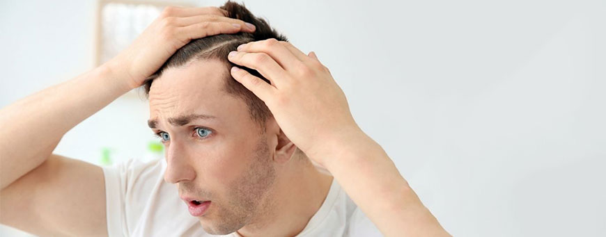 ▷ Hypothyroidism and hair loss: is it reversible? – Clinicana