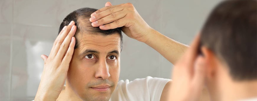 ▷ Seasonal Hair Loss: When should we worry about it