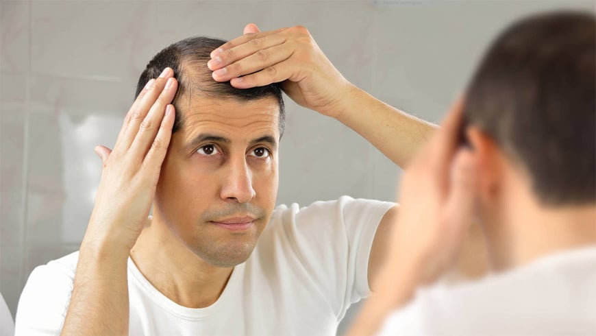 ▷ Seasonal Hair Loss: When should we worry about it