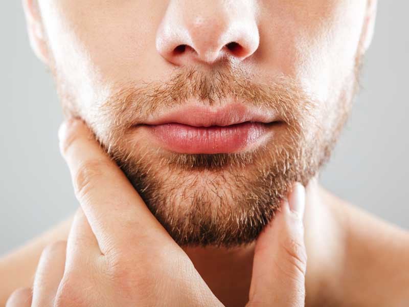 ▷ Patchy Beard: how to fix patchy beards | Clinicana ▷ Patchy Beard: how to fix patchy beards | Clinicana
