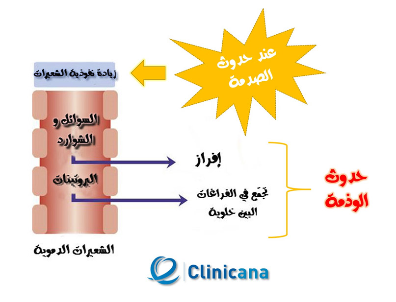 تكون قشرة الشعر بعد زراعة الشعر