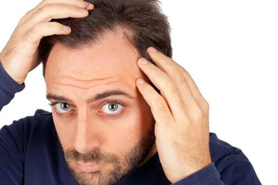 Przeszczep włosów: pytania I odpowiedzi