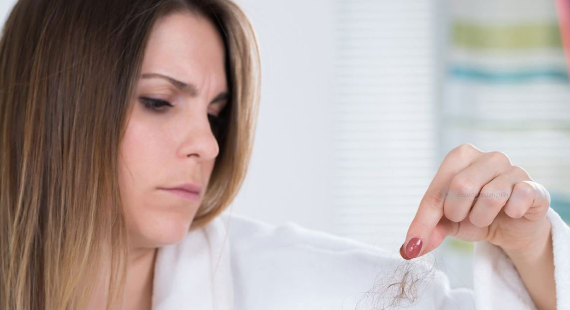 Alopecia frontal fibrosante en mujeres: ¿qué tratamiento tiene?