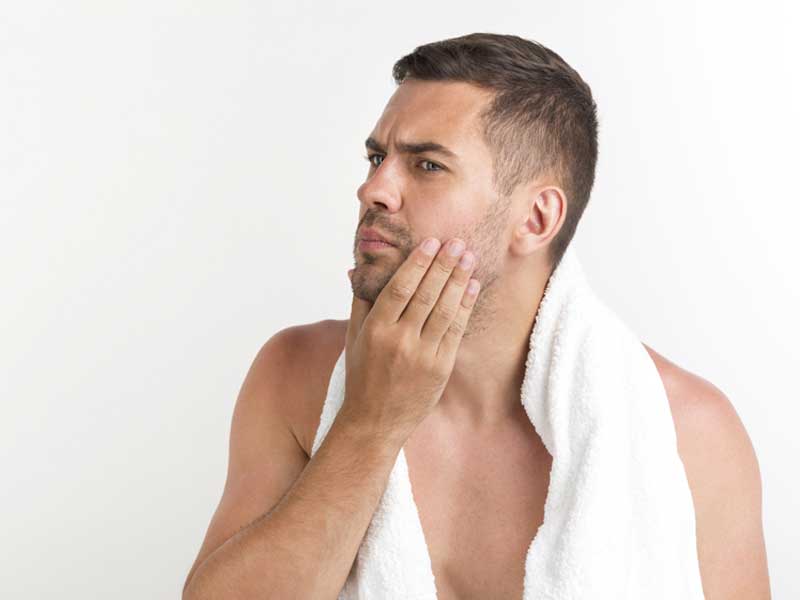 Calvas en la barba: causas & tratamiento