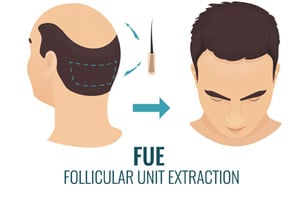 Zabieg FUE: jakie są jego skutki uboczne po przeszczepie włosów?