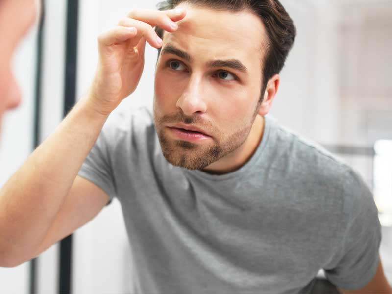 Hair Miniaturization: signs, diagnosis, and treatment