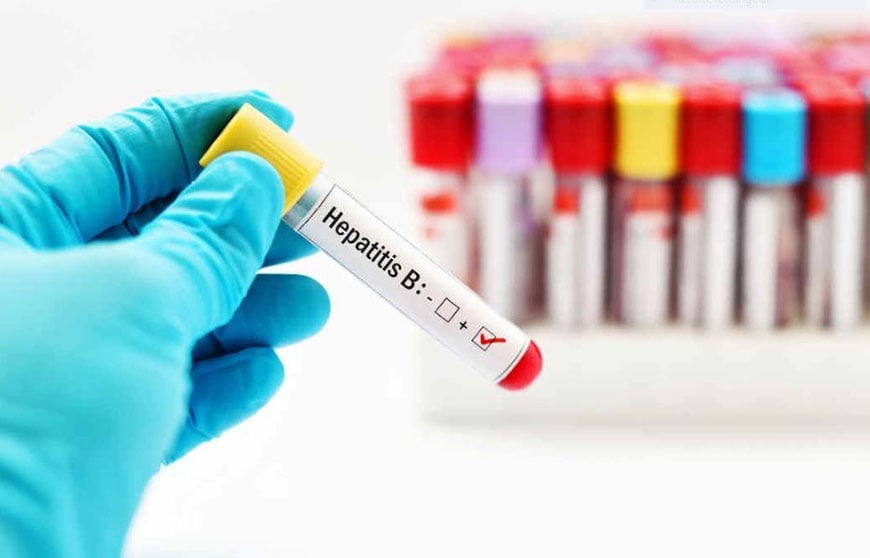 Hepatit B vs. hårtransplantationsprocedur