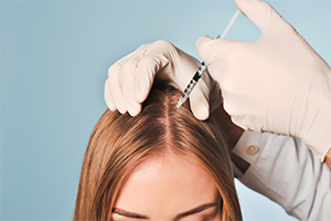 علاج الميزوثيرابي لتساقط الشعر: هل يساعد على إعادة نمو الشعر؟