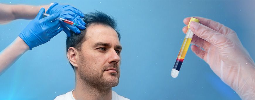 PRP Therapy for Hair Loss in Turkey: Combining Hair Transplant with Platelet-Rich Plasma