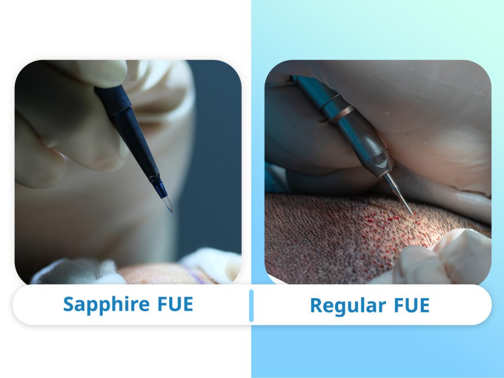 What-is-Sapphire-FUE