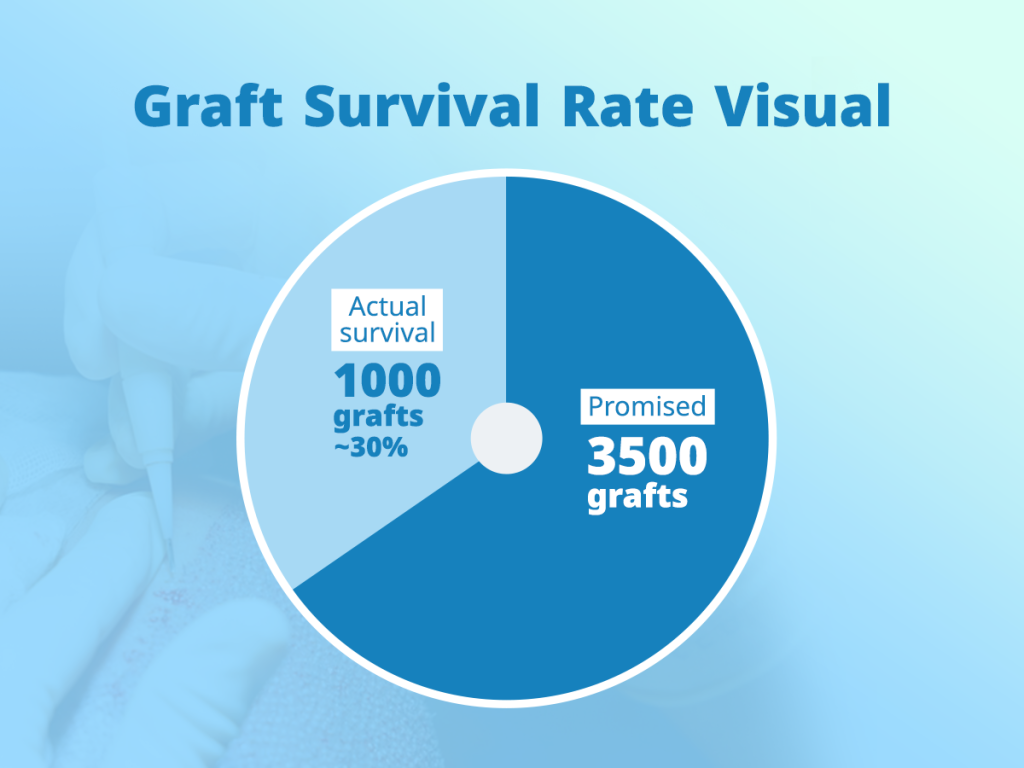Visual representation of failed graft survival rate from an ultra-cheap hair transplant in Turkey