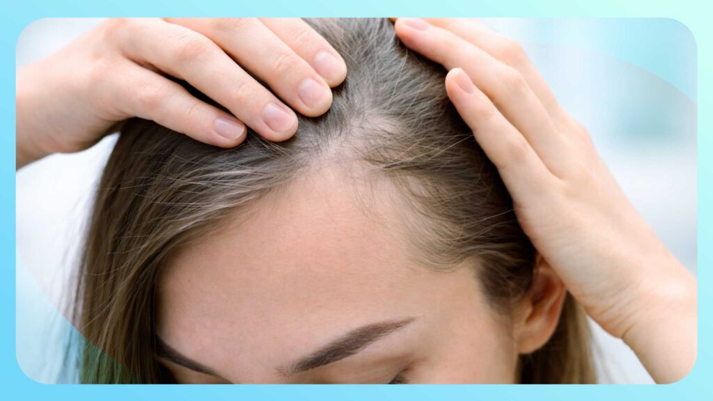 Female Hair Transplant in Turkey: A Complete Guide to Techniques, Recovery, and True Results