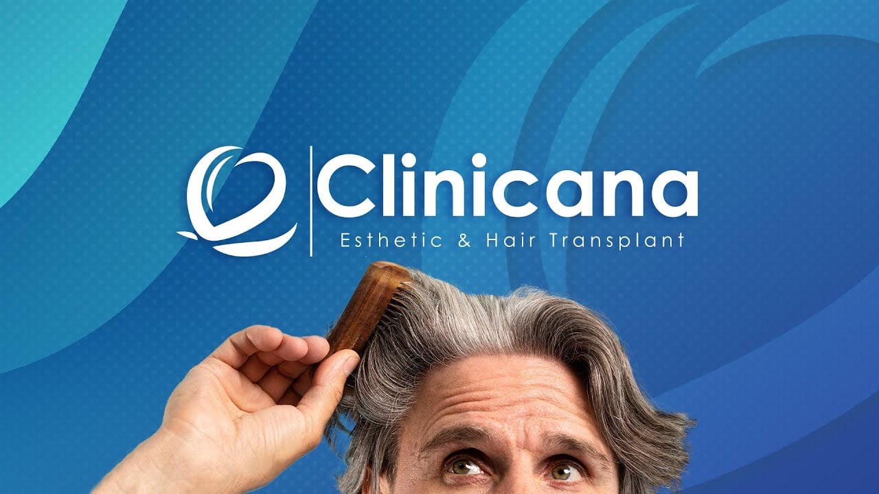 Natural looking hair transplant at Clinicana