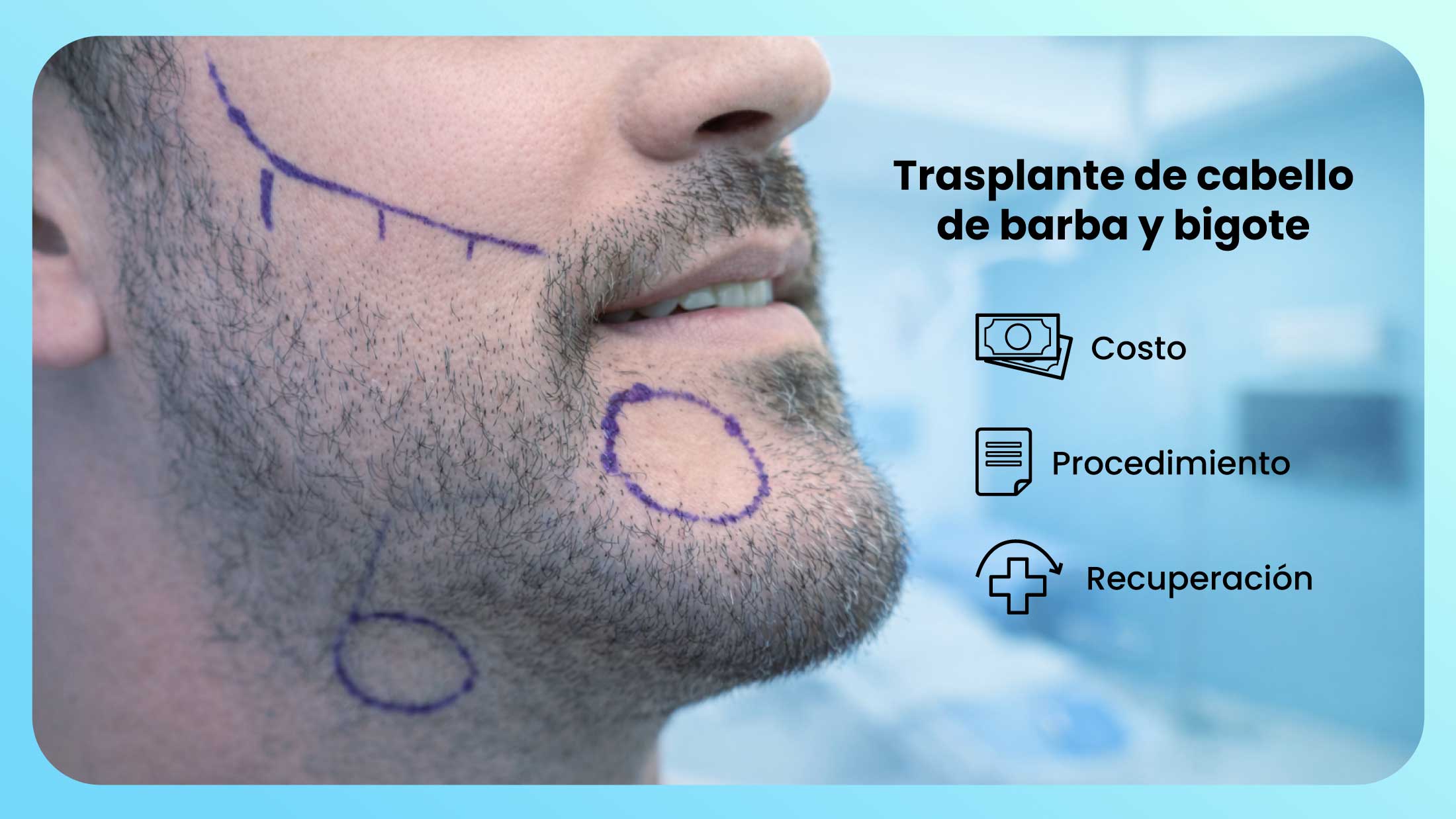 Trasplante de Barba y Bigote en Turquía: Procedimiento, Costo y Recuperación