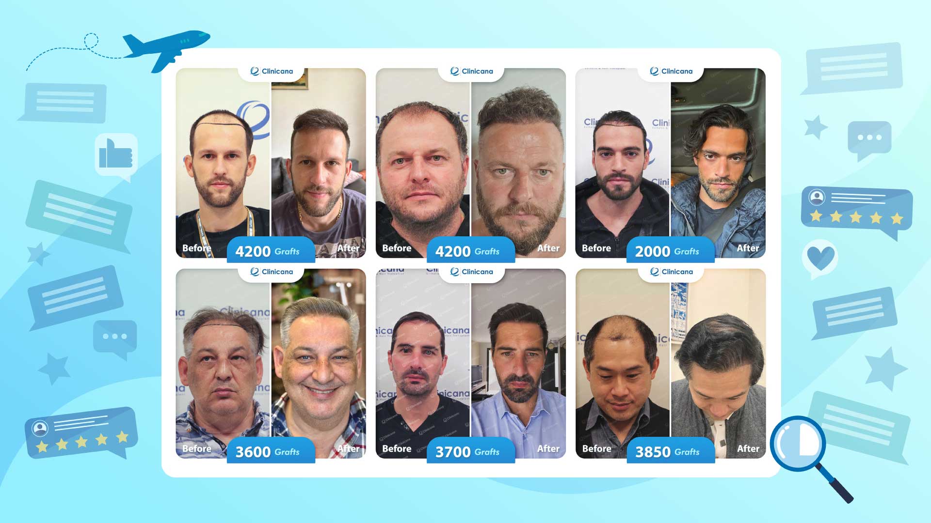 هل عملية زراعة الشعر مؤلمة؟ الحقيقة الكاملة وتجربة المرضى في كلينيكانا