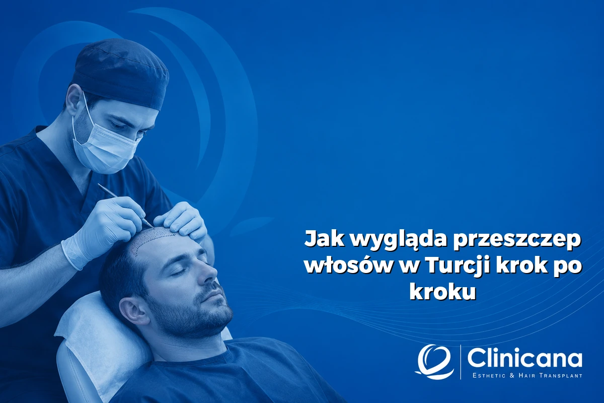 jak wygląda zabieg FUE krok po kroku