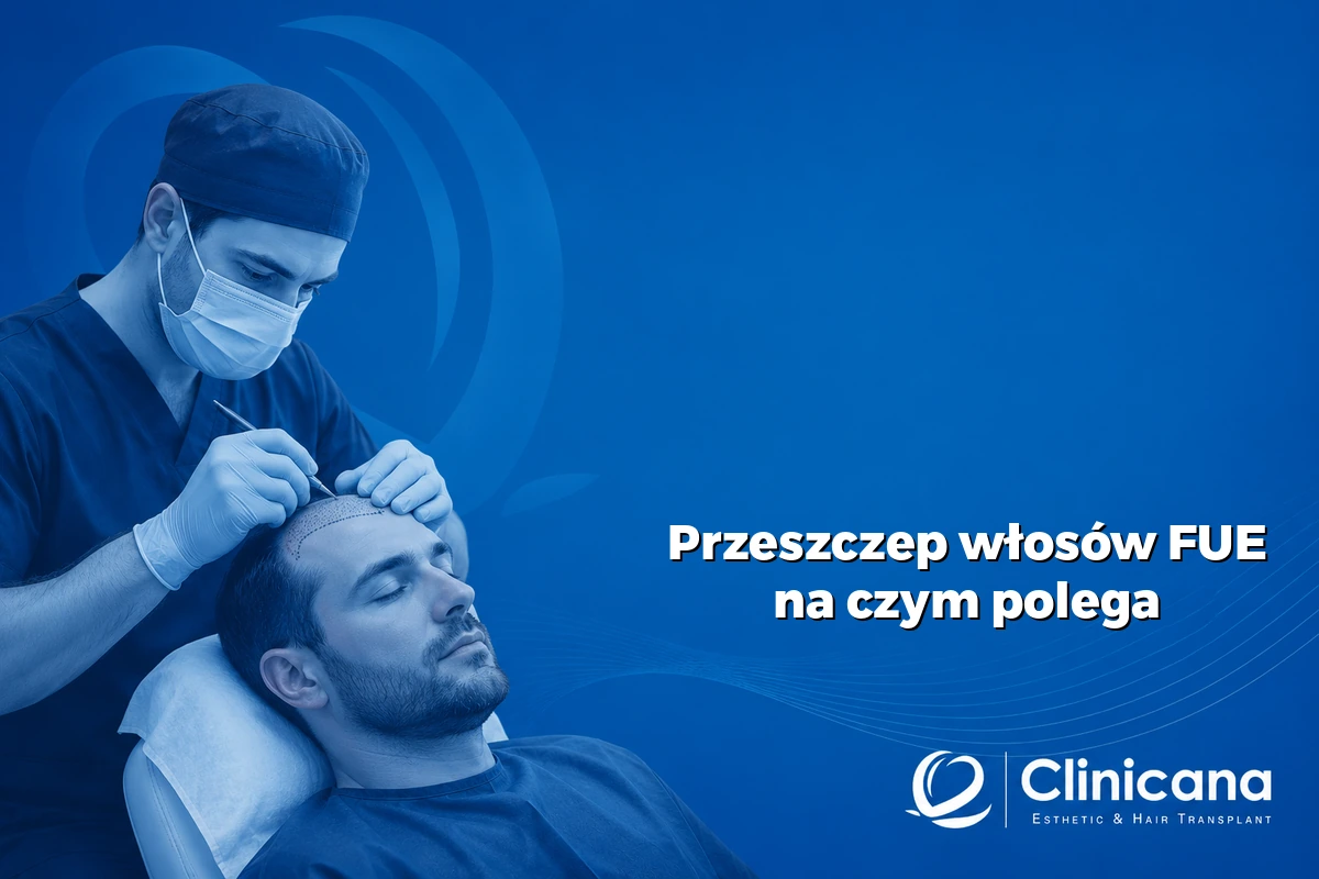przeszczep włosów FUE na czym polega