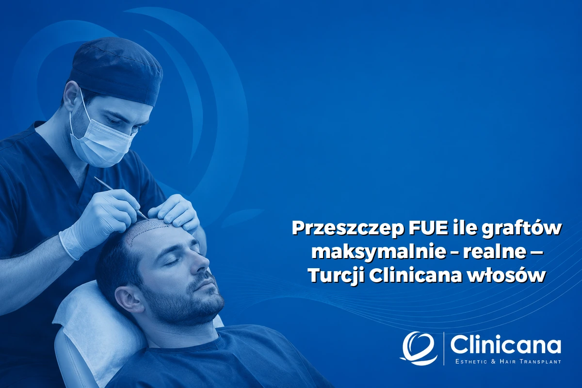 przeszczep FUE ile graftów maksymalnie