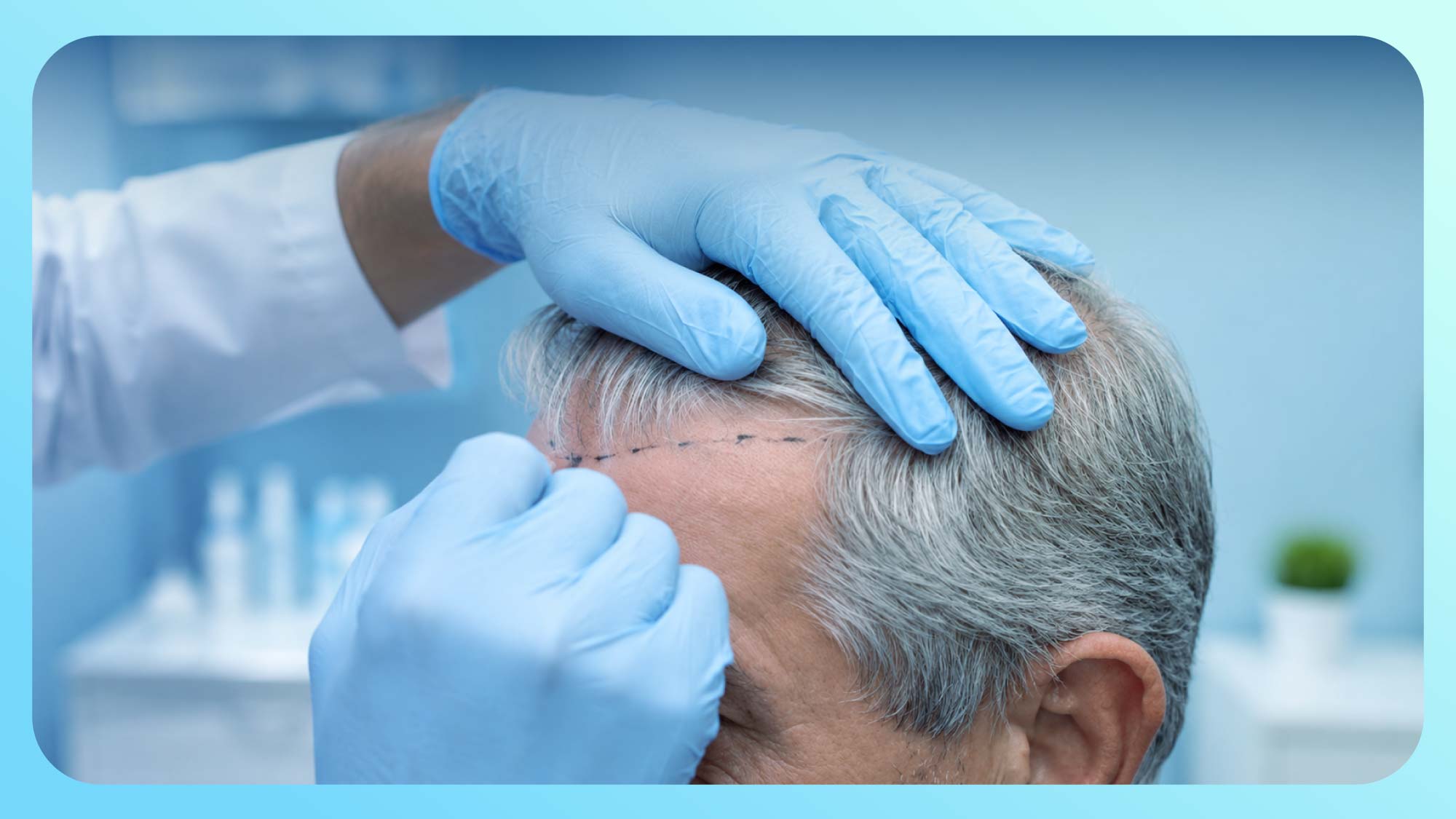 Is a hair transplant with grey hair possible?
