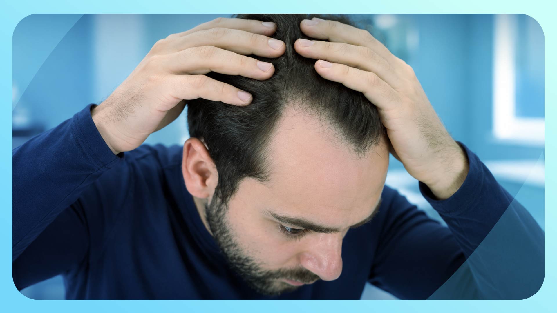 Hair Loss Treatment Turkey: What Your Doctor Won’t Tell You Back Home