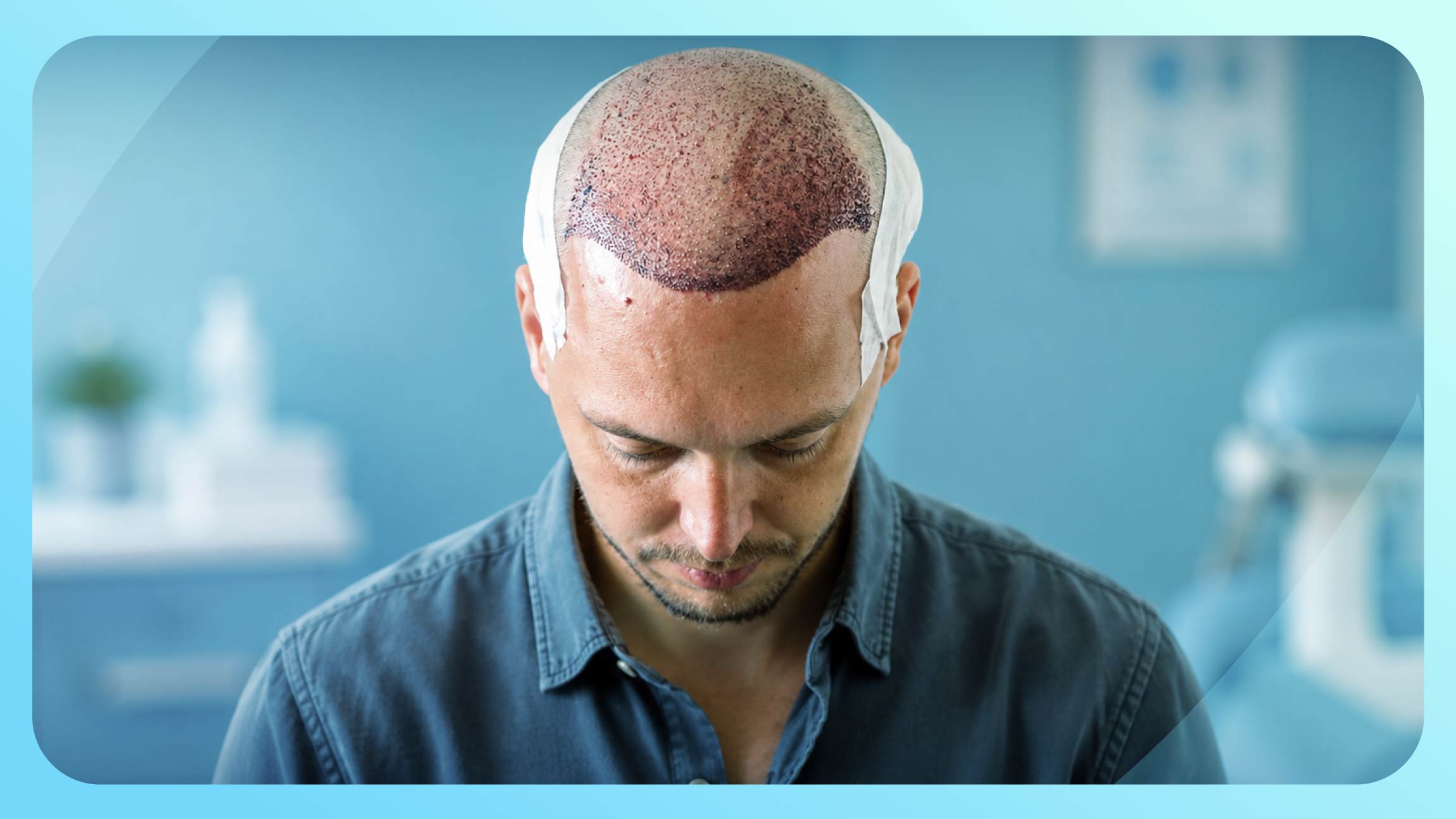 Scabs after your hair transplant