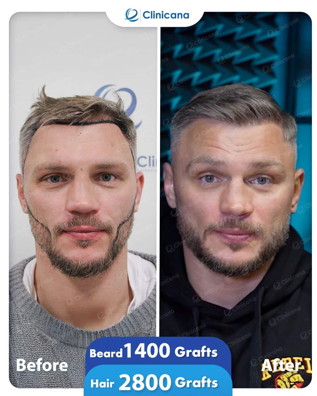 before&after