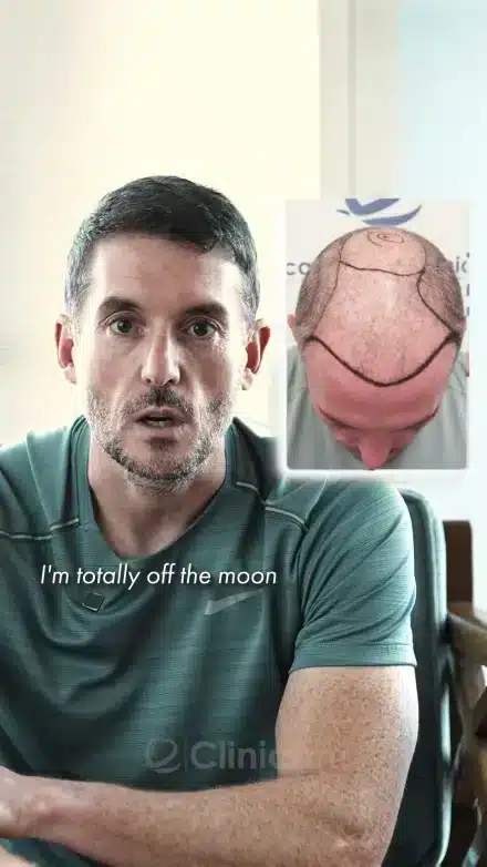 Clinicana patient story video thumbnail