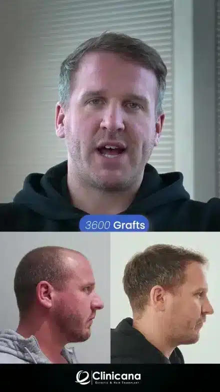 Clinicana patient story video thumbnail