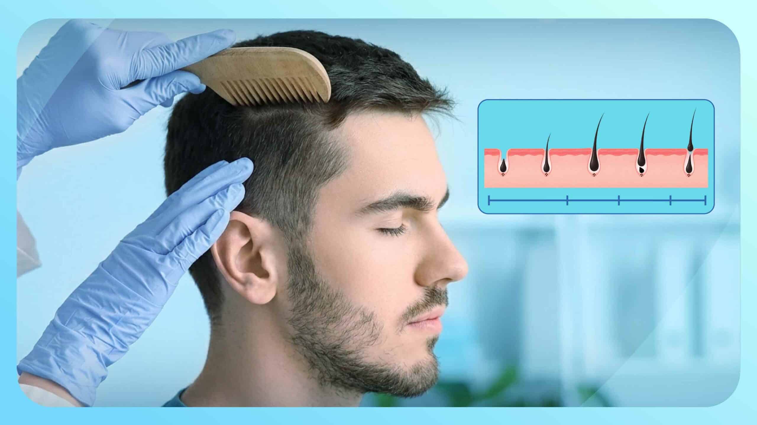 تركيب الشعر ومراحل نموه المختلفة: دليل تشريحي وطبي عن البصيلات