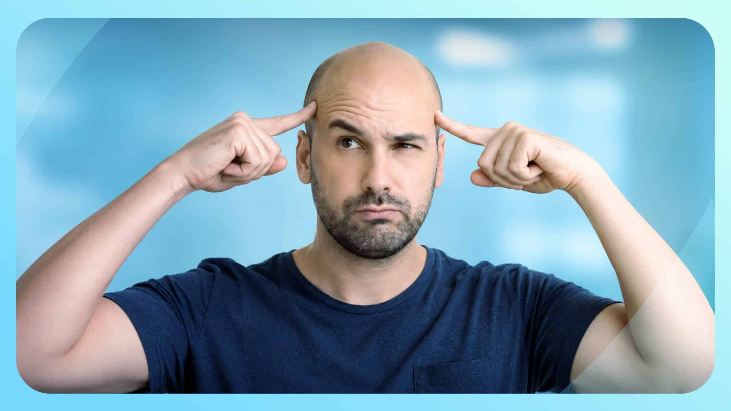 علامات الإصابة بالصلع المبكر وكيفية التنبؤ بها والوقاية منها