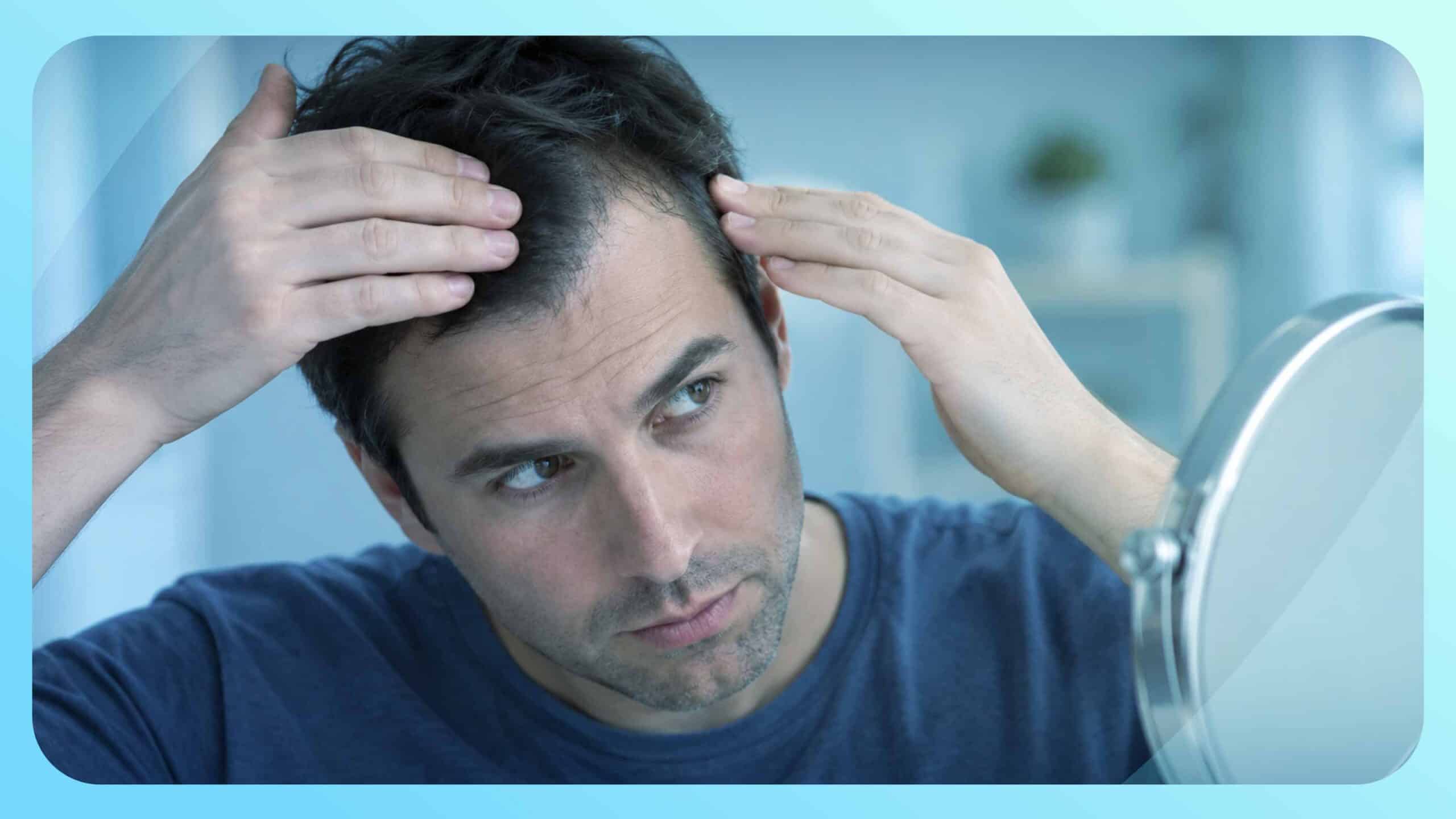 Is a Widow’s Peak Hairline Normal, Genetic, or a Sign of Balding?