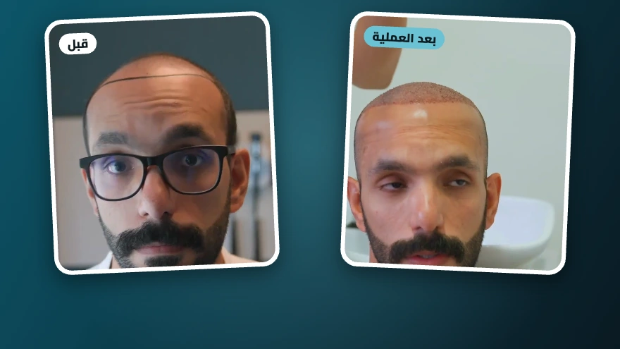 محمود · 4200 بصيلة