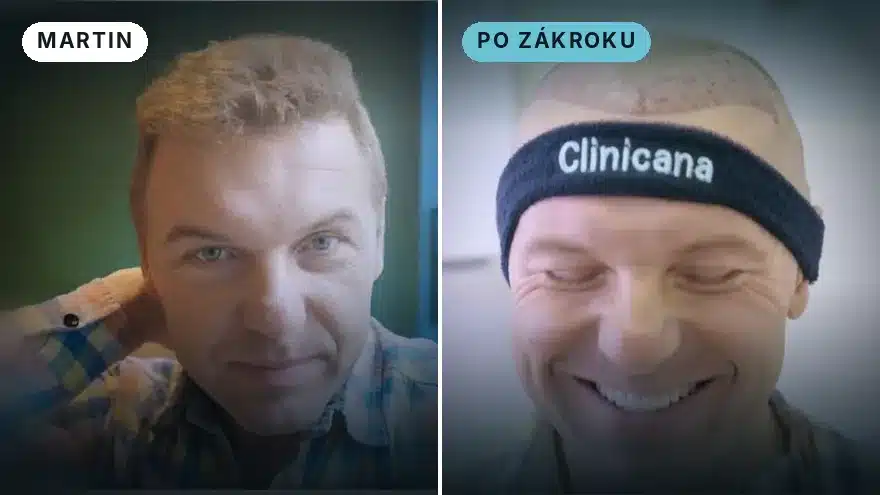 Martin ze Slovenska · druhý zákrok