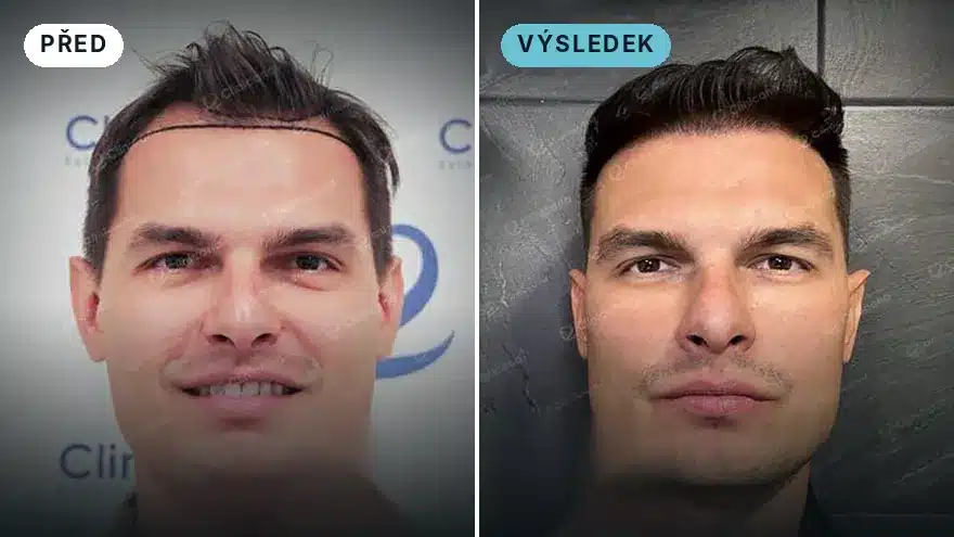 Martin ze Slovenska · 2 050 štěpů