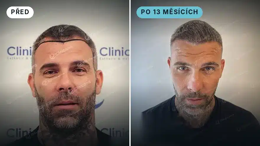 Miroslav · 2 700 štěpů · po 13 měsících