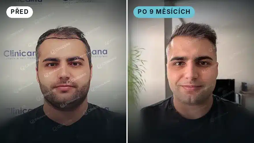 Nikolas · 4 000 štěpů · po 9 měsících