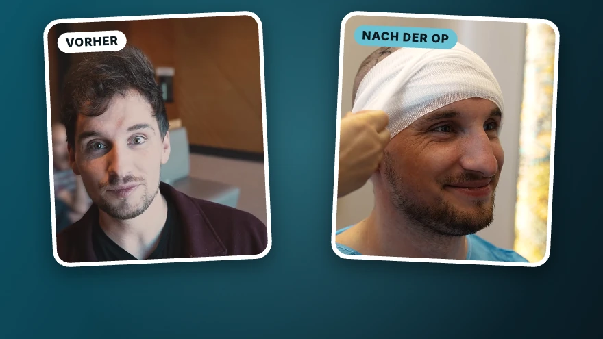 Toni · 3.800 Grafts