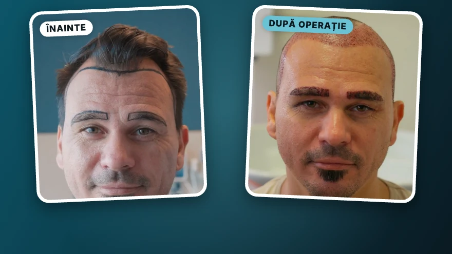 Alin · păr și sprâncene