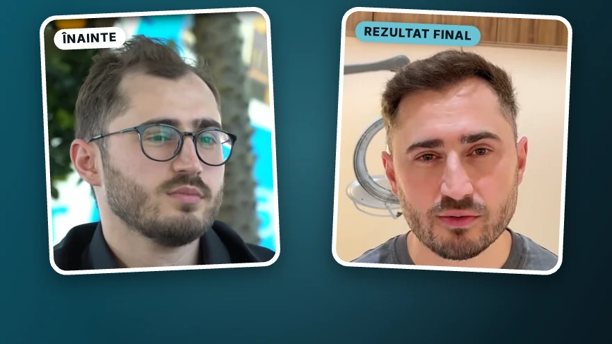 Cristian · după 2 operații